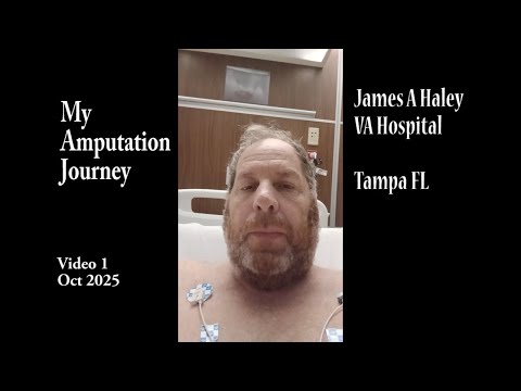 Видео: Видео о моем пути ампутации 1