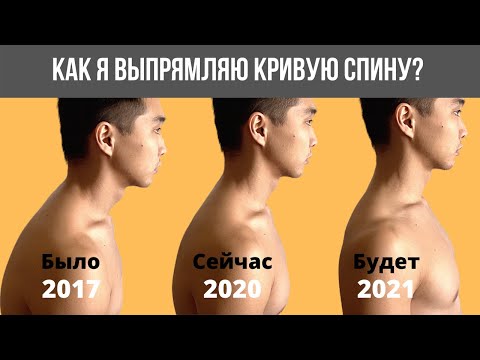 Видео: У меня был абсолютно кривой позвоночник, пока я не начал делать это | Кифоз, Лордоз, Сколиоз