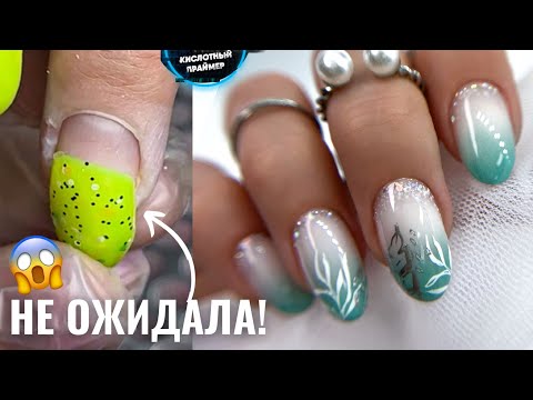 Видео: ШОК! ОТСЛОИЛСЯ ВЕСЬ Ноготь! Что ЭТО Может быть?