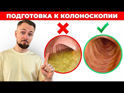 Видео: ПРАВИЛЬНАЯ подготовка к колоноскопии от доктора Маторина. Схема приема слабительного препарата.
