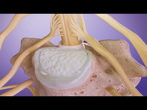 Видео: Как периферическая нейропатия влияет на организм