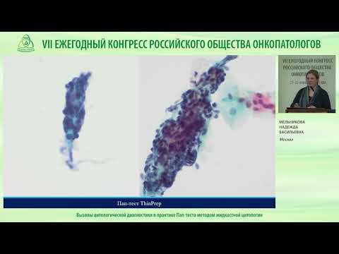 Видео: Вызовы цитологической диагностики в практике Пап-теста методом жидкостной цитологии