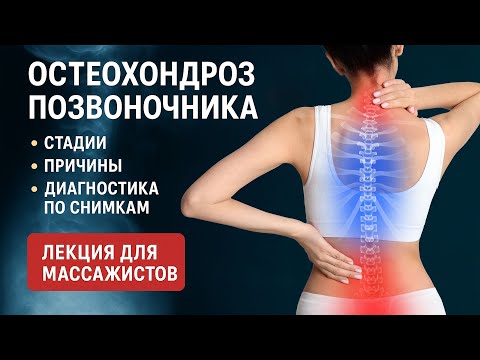 Видео: ОСТЕОХОНДРОЗ ПОЗВОНОЧНИКА: Стадии, Причины, Диагностика по снимкам. ЛЕКЦИЯ ДЛЯ МАССАЖИСТОВ