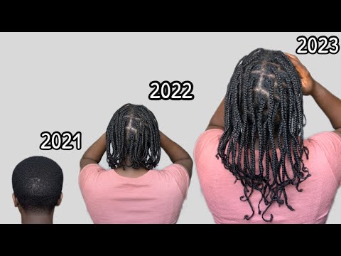 Видео: НАРАЩИВАНИЕ ВОЛОС С ПОМОЩЬЮ МИНИКОСИК / КАК ОТРАСТИТЬ ВОЛОСЫ С ПОМОЩЬЮ МИНИКОСИК.