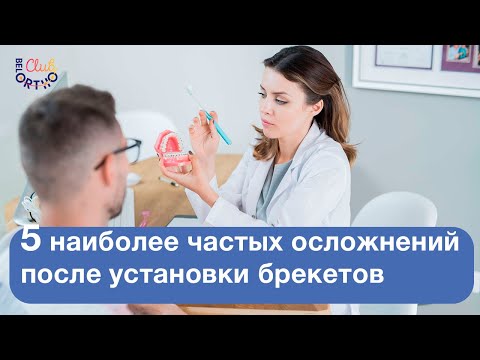 Видео: 5 наиболее частых осложнений после установки брекетов | БелоОртоКлуб