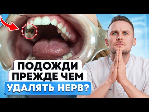 Видео: Что делать, если вам сказали удалить ЗУБ или УДАЛИТЬ НЕРВ?