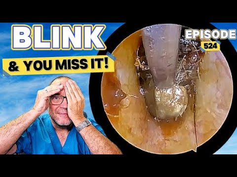 Видео: МОРГНИ — И ТЫ ЭТО ПРОПУСТИШЬ! Эпизод 524 (подборка для 5 ушей!)