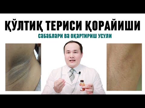 Видео: ҚЎЛТИҚ ҚОРАЙИБ КЕТИШИ САБАБЛАРИ ВА ОҚАРТИРИШГА ТАБИИЙ УСУЛЛАРИ ҲАҚИДА ДОКТОР ИСЧАНОВ
