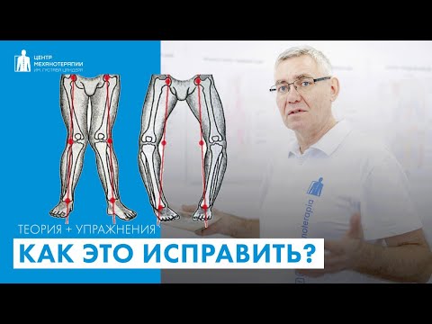 Видео: Как ножки сделать прямыми с помощью упражнений?