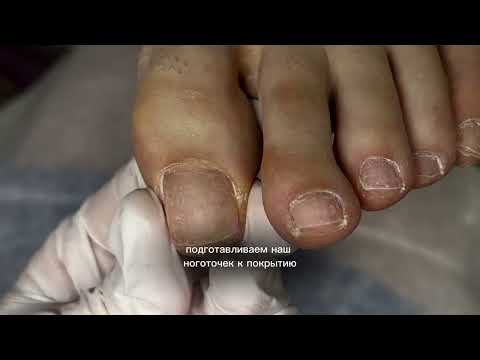Видео: Педикюр | покрытие гель лаком #ногти #эстетика #дизайнногтей #аппаратныйпедикюр #гельлак #педикюр