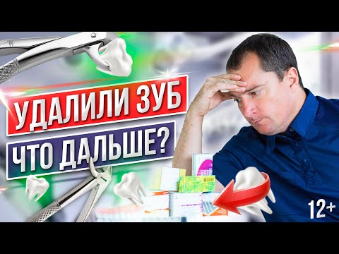 Видео: Что Делать После Удаления Зуба? Рекомендации После Удаления Зуба