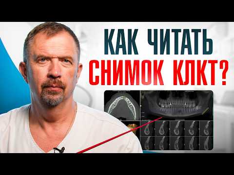 Видео: Как интерпретировать КТ ВНЧС: СЕКРЕТЫ ТОЧНОЙ ДИАГНОСТИКИ!