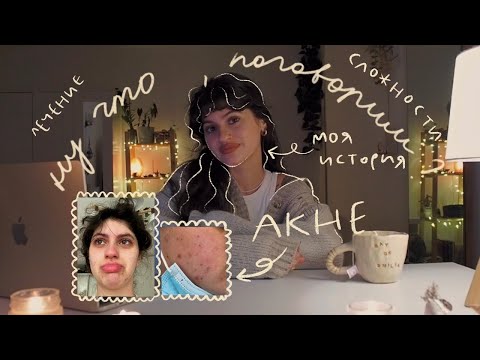 Видео: История моей кожи ♡ борьба с акне• ненависть к себе • безысходность и лечение