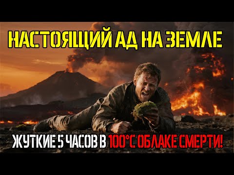 Видео: ОБГОРЕЛ ЗАЖИВО В 2 КМ ОТ ВУЛКАНА, НО ВЫЖИЛ: ЕГО ЛЕГКИЕ – ПЕПЕЛ...