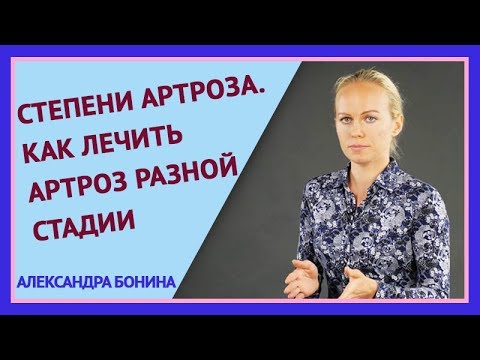 Видео: ►СТЕПЕНИ АРТРОЗА коленного и тазобедренного сустава (стадии). Как лечить артроз на разных стадиях.