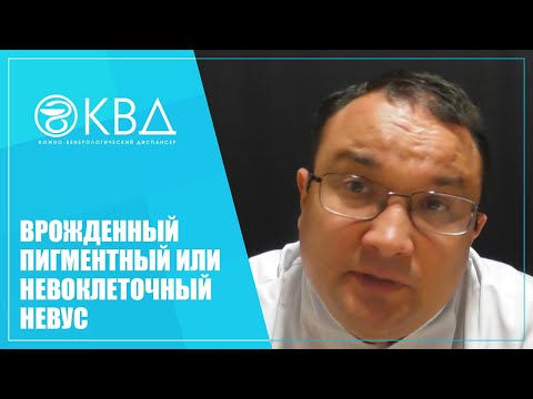 Видео: 1343  Врожденный пигментный или невоклеточный невус