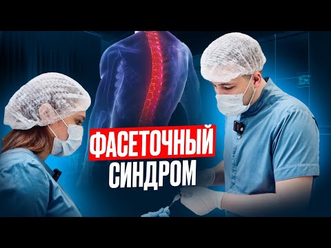 Видео: ФАСЕТОЧНЫЙ СИНДРОМ | Что такое фасетки, симптомы фасет. синдрома, диагностика, лечение