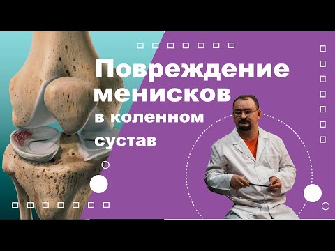 Видео: Повреждение менисков в коленном суставе