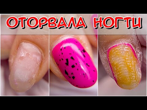 Видео: Оторвала ногти / ковыряшка / ковыряет ногти / Маникюр / Преображение ногтей