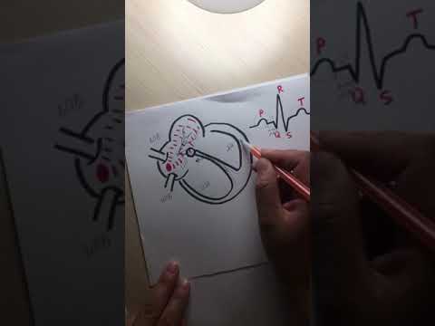 Видео: ЭКГ (зубец P, интервал P-Q, комплекс QRS)