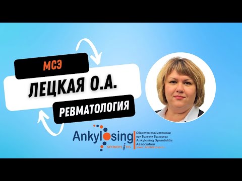 Видео: Прохождение медико-социальной экспертизы при РЗ #ревматология #инвалидность