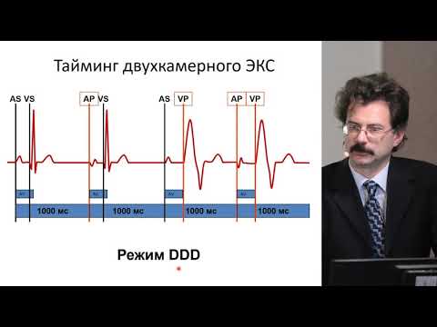 Видео: Холтеровское мониторирование пациентов со стимулятором. Часть 1: особенности заключения