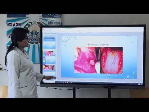 Видео: Хронический рецидивирующий афтозный стоматит