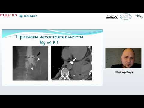 Видео: Лучевая диагностика. Шрайнер И.