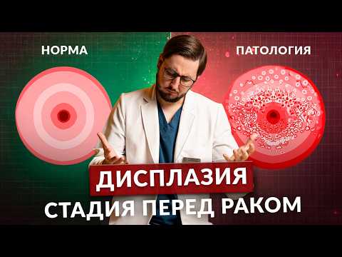 Видео: Дисплазия шейки матки это рак или нет?