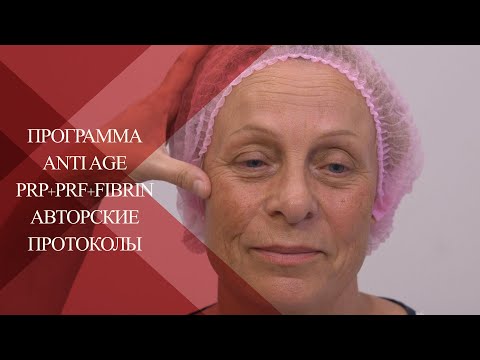 Видео: 💉 PRP+Plasmogel+Fibrin| Авторский протокол | Про методику fullface в Anti-Age терапии |