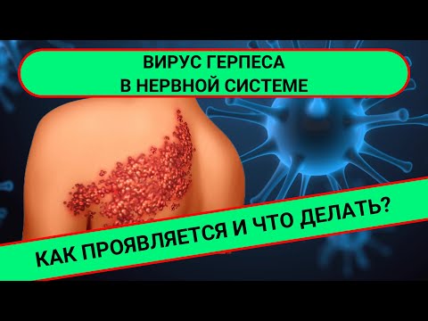 Видео: ВИРУС ГЕРПЕСА И НЕРВНАЯ СИСТЕМА: как они связаны?