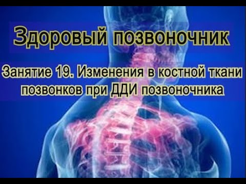 Видео: Занятие 19. Изменения в костях позвонков при дегенеративно-дистрофических поражениях позвоночника