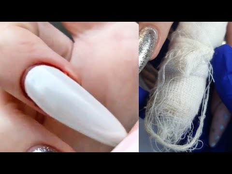 Видео: СОРВАЛА НОГОТЬ🥺Ааааа  что делать ?