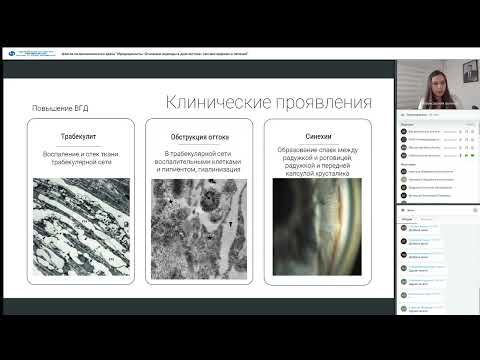 Видео: ШПВ Иридоциклиты  Основные подходы в диагностике, тактике ведения и лечения. 18.05.23