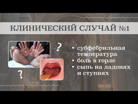Видео: Клинический случай №1 (терапия, врач терапевт) | Разбор клинического случая из терапии