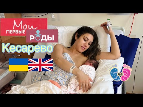 Видео: Роды в Великобритании(БЕЗ ЦЕНЗУРЫ)/Плановое Кесарево сечение/Все этапы родов/Первые роды