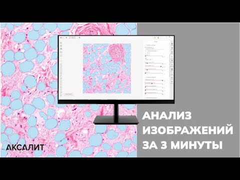 Видео: Анализ биологических образцов: методика, инструменты, результаты