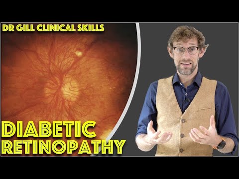 Видео: Как использовать офтальмоскоп для проверки на диабетическую ретинопатию — доктор Гилл