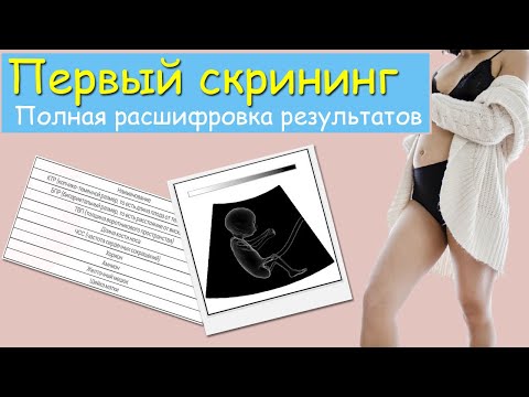 Видео: Первый скрининг. Полная расшифровка результатов узи и крови