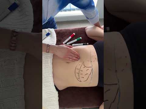 Видео: Массаж внутренних органов. Практика меняющее здоровье.