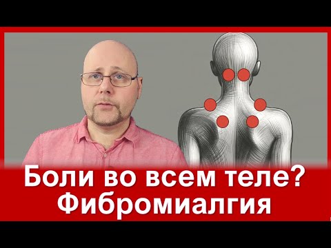 Видео: Беспокоят боли во всем теле? Возможно у вас фибромиалгия!