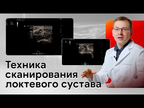 Видео: Техника проведения УЗИ локтевого сустава на Mindray Imagyn i9