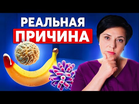 Видео: Хламидии и гонорея: признаки и симптомы, которые нужно знать
