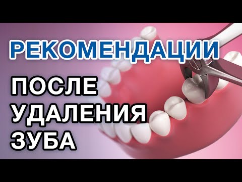 Видео: Что делать после удаления зуба? РЕКОМЕНДАЦИИ ПОСЛЕ УДАЛЕНИЯ ЗУБА