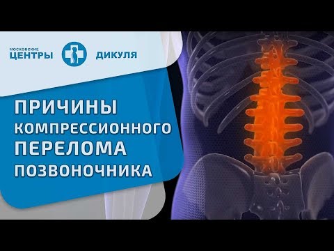 Видео: Компрессионный перелом позвоночника. Вопрос-ответ.