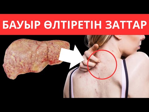 Видео: Бауырды ӨЛТІРЕТІН ТОП 10 Тағам. Бауырды өлтіретін әдеттер