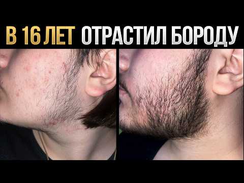 Видео: Из пушка в бороду за 4 месяца / Результаты средства для роста бороды mr.Volos