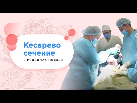 Видео: Кесарево сечение бесплатно по полису ОМС