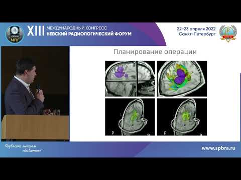 Видео: НАУЧНАЯ ШКОЛА «МРТ Будущего  Тренды». Часть 1