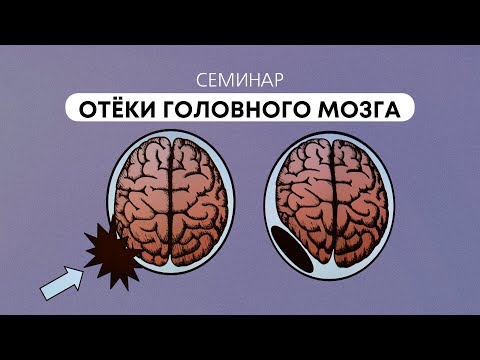 Видео: Отёки головного мозга